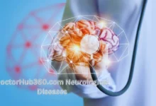 DoctorHub360.com Neurological Diseases